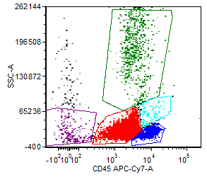 Figure 6a: Flow cytometry, peripheral blood. Blasts (red) are CD45+ (moderate), CD7+, CD11b+, CD34+, and CD117+ (partial). Surface CD3 is negative.